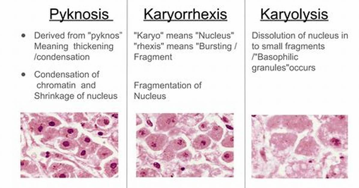 How to Explain Pyknosis?