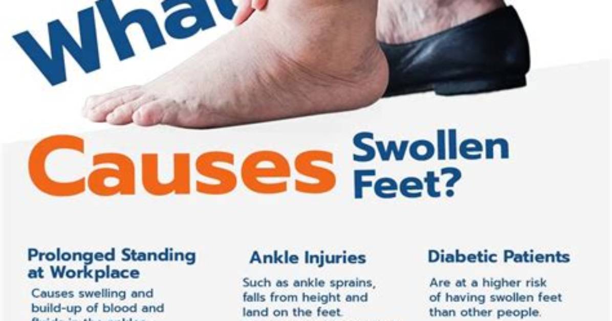 How to Fix Swollen