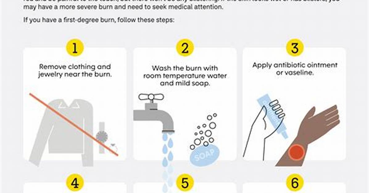 How to Get Burns off of a Suede Couch