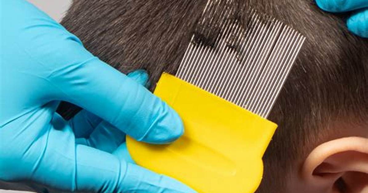 How to Get Rid of Bed Lice