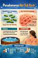 How to Get Rid of Hot Water Odor