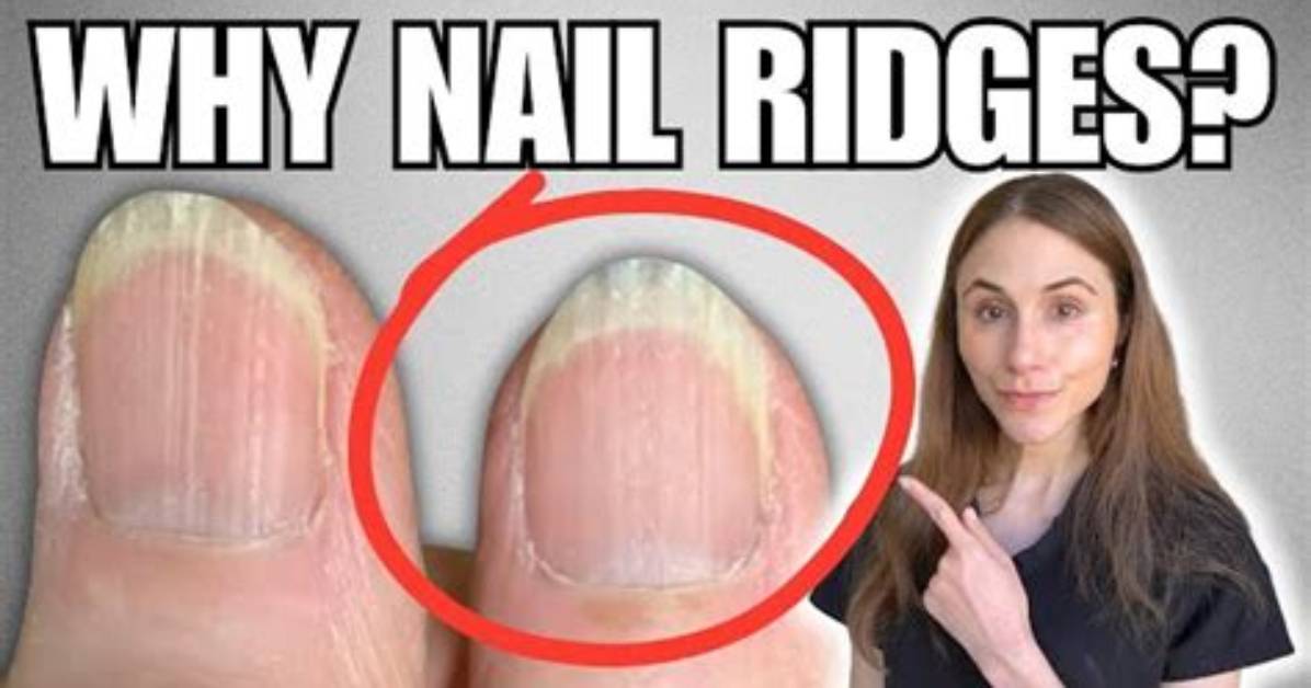 How to Get Rid of Ridges in Nails: a Comprehensive Guide for Strong and Healthy Nails
