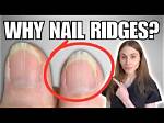 How to Get Rid of Ridges in Nails: a Comprehensive Guide for Strong and Healthy Nails