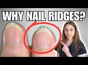 How to Get Rid of Ridges in Nails: a Comprehensive Guide for Strong and Healthy Nails