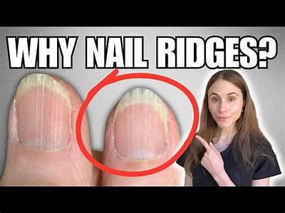 How to Get Rid of Ridges in Nails: a Comprehensive Guide for Strong and Healthy Nails
