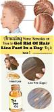 How to Kill Head Lice at Home on Carpets, Beds & Clothes