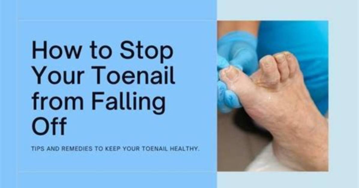 How to Prevent Toenail from Falling off?