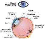 How to Prevent Uveal Melanoma?