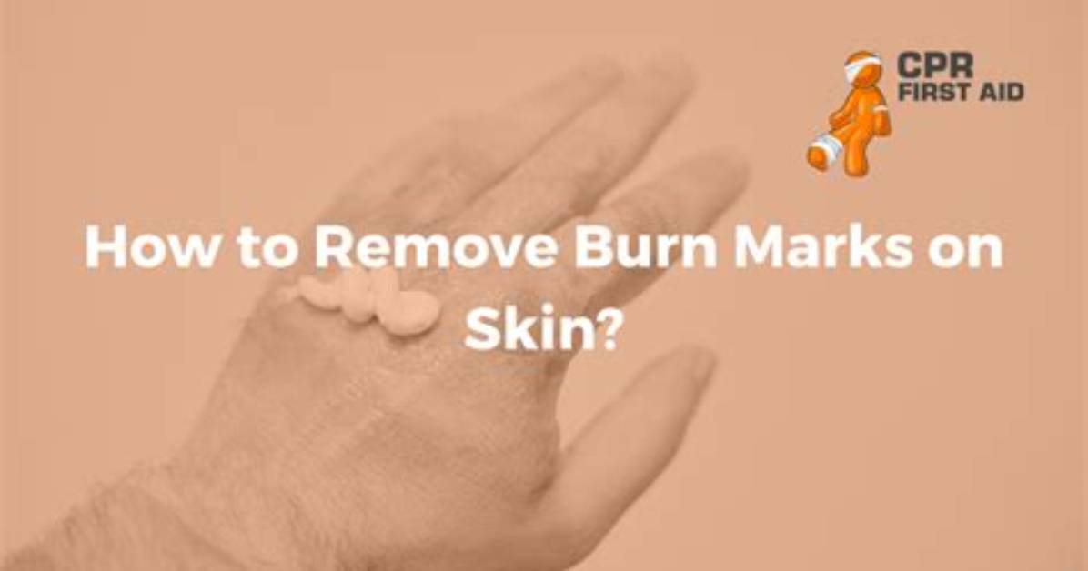 How to Remove a Burn Mark from A