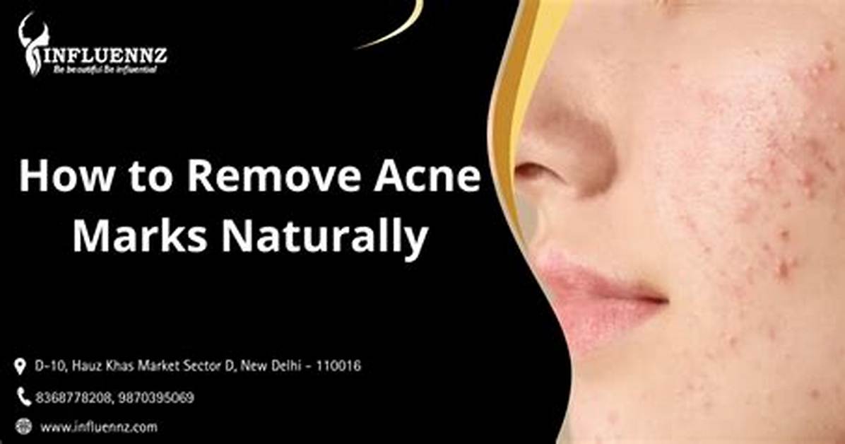 How to Remove Marks from A