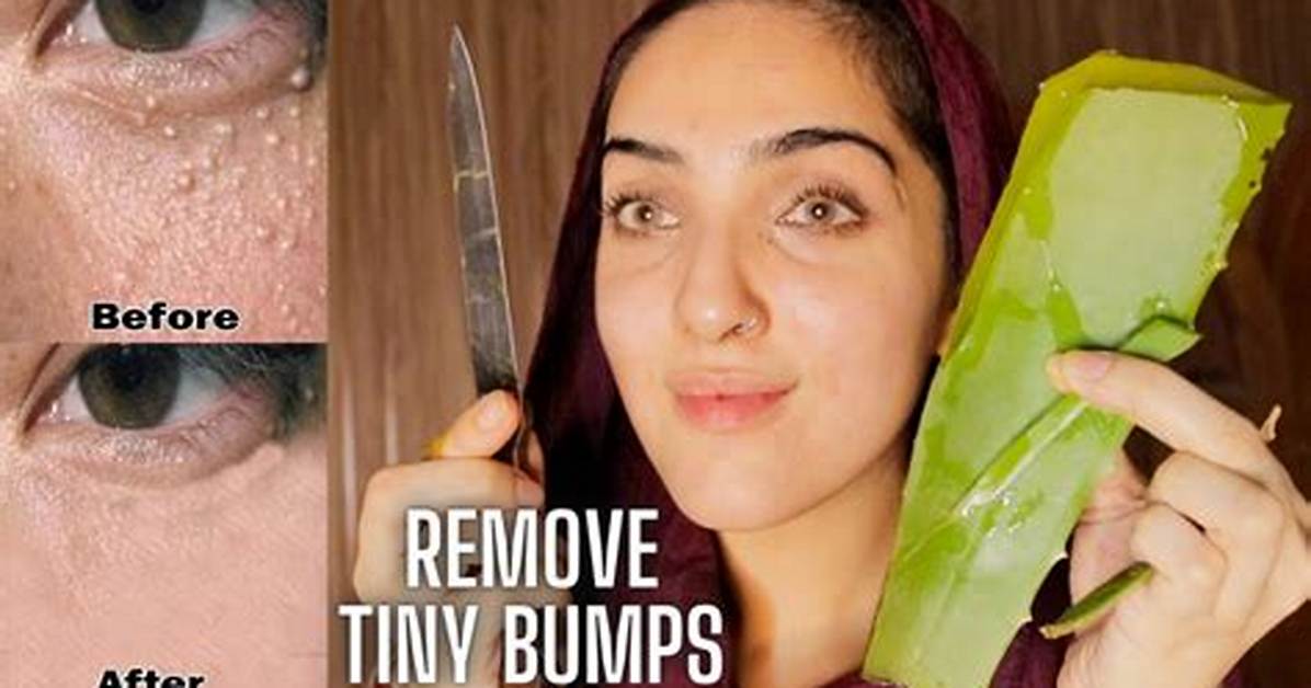 How to Remove Tiny