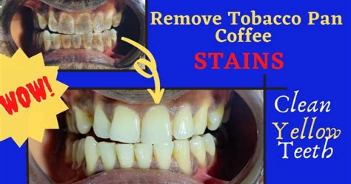 How to Remove Yellow Tobacco Stains From