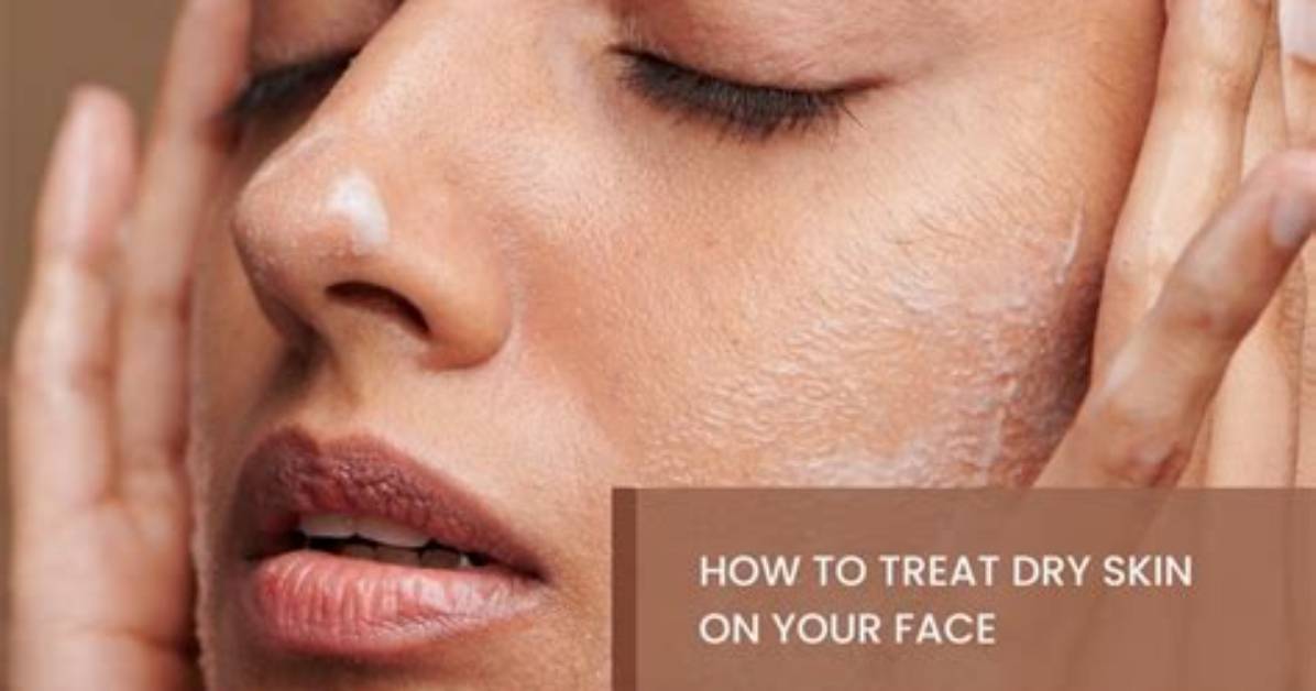 How to Treat Dry
