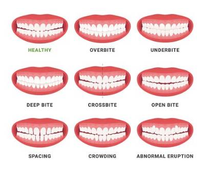 How Wide Should the Mouth Be?