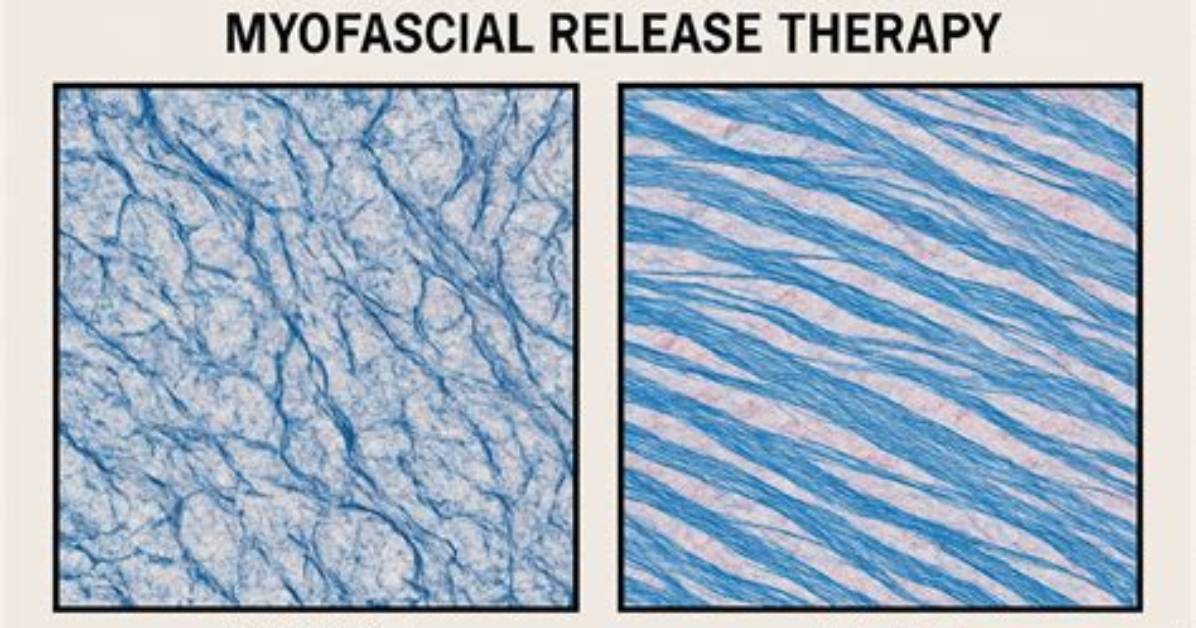 How Will I Feel After Myofascial Release?