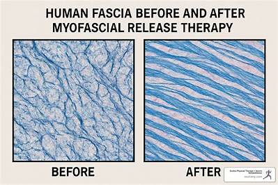 How Will I Feel After Myofascial Release?