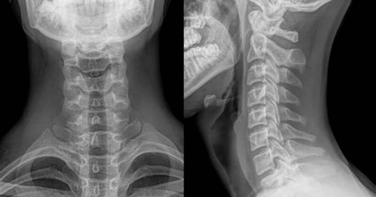 “Impact Injury, Neck Lacerations”: Audio Reveals Details About Lindsay Clancy 911 Call