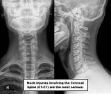 “Impact Injury, Neck Lacerations”: Audio Reveals Details About Lindsay Clancy 911 Call