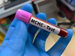 In Blood Test What Is Mchc?
