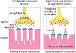 In Myasthenia Gravis Acetylcholine?