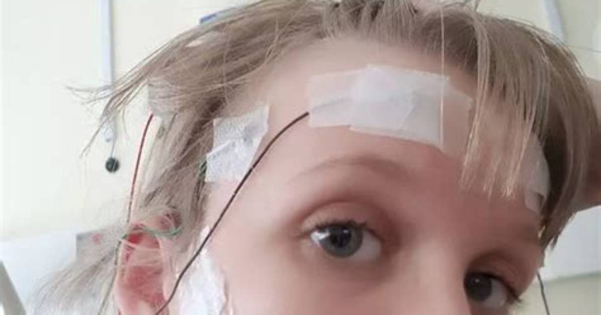 Internally Decapitated: Understanding the Rare and Complex Medical Condition