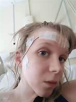 Internally Decapitated: Understanding the Rare and Complex Medical Condition