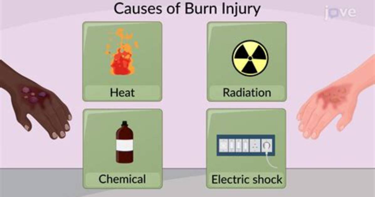 Is a Burn an Injury?