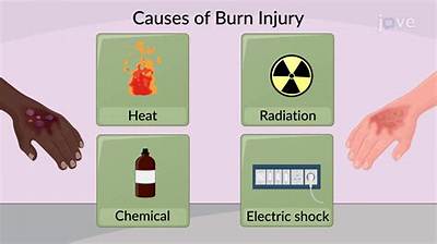 Is a Burn an Injury?