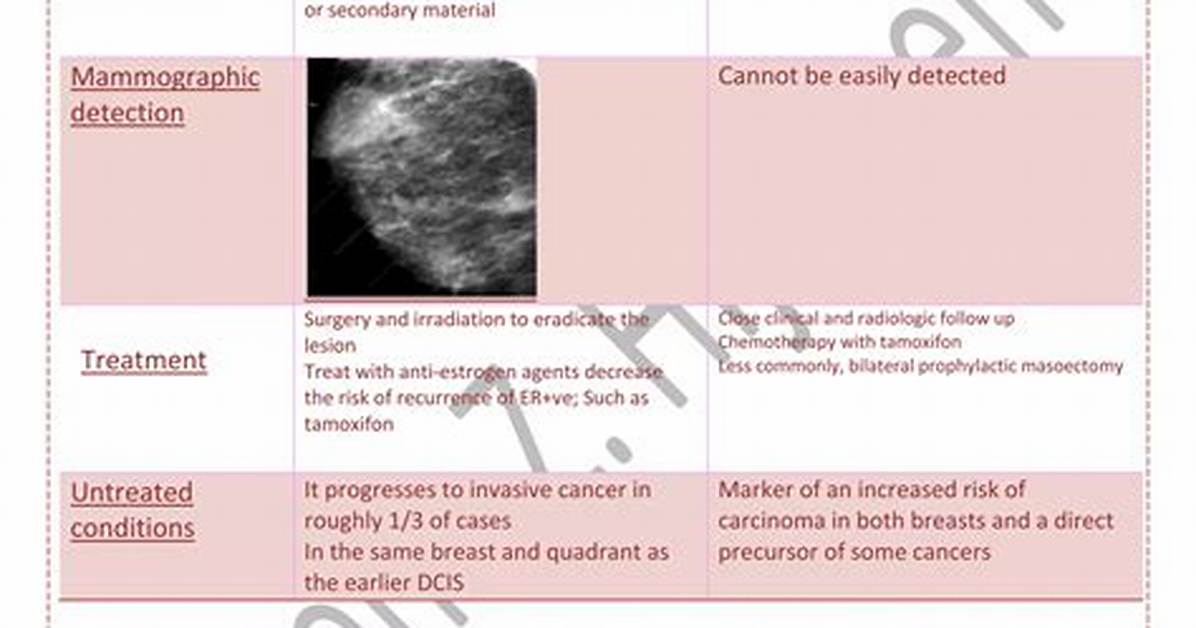 Is Dcis Caused by Stress?