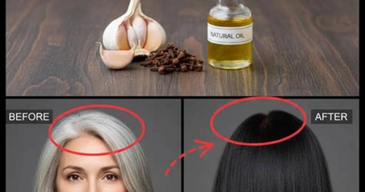 Is Garlic Good for Gray Hair?