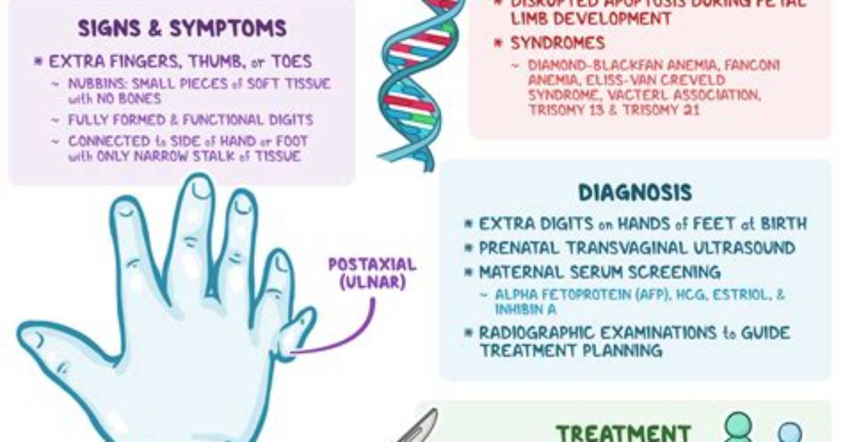 Is Having an Extra Finger Genetic?