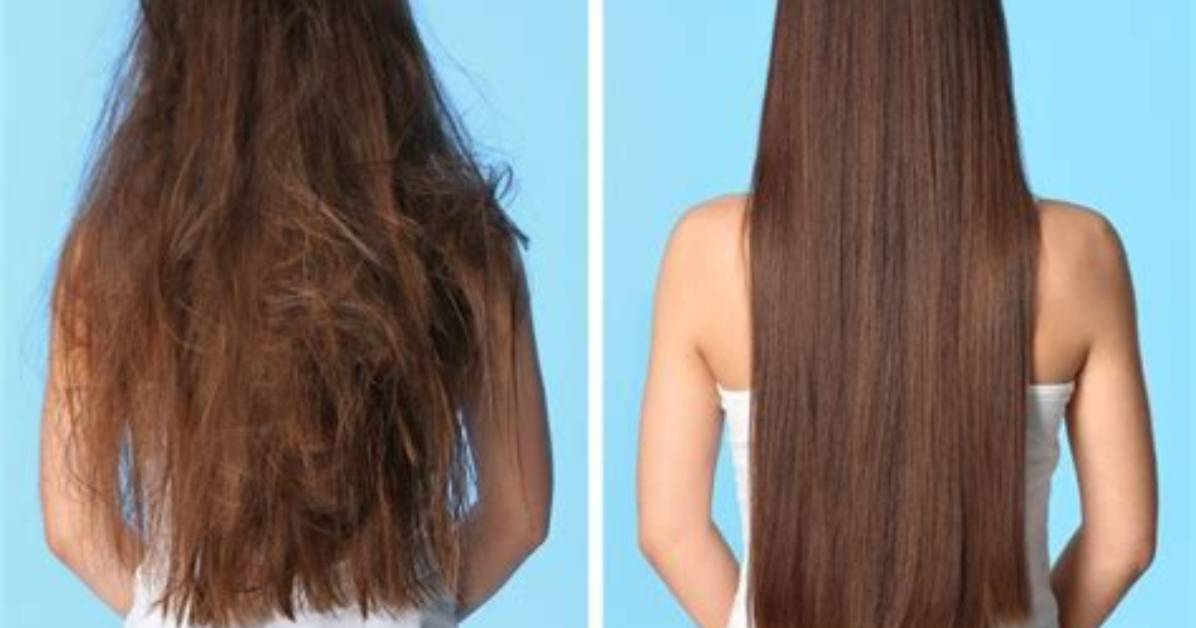 Is It Better to Shower at Night or in the Morning for Acne?