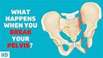 Is It Easy to Break Your Pelvic Bone?