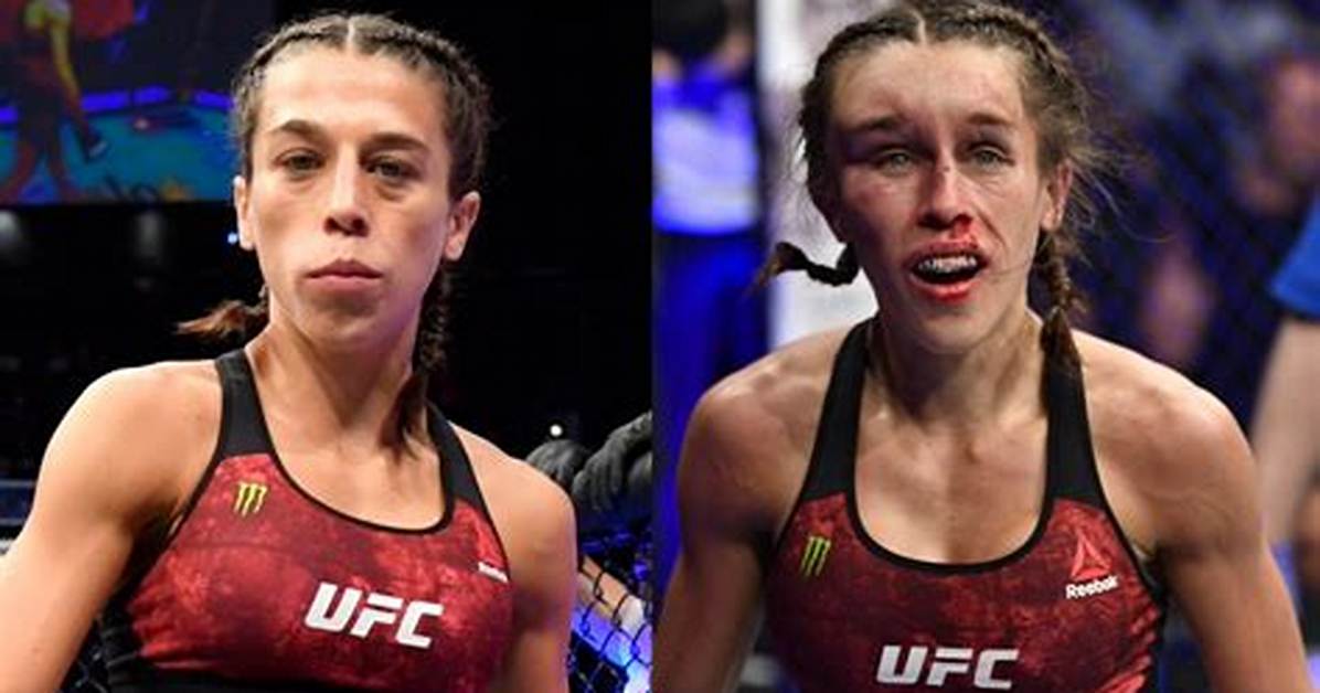 Is Joanna Jedrzejczyk Called Megamind Due to Disfigured Forehead? Injury and Health Update