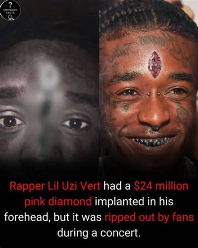 Is Lil Uzi Vert Diamond Really 24 Million?