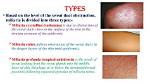 Is Miliaria Crystallina Contagious?