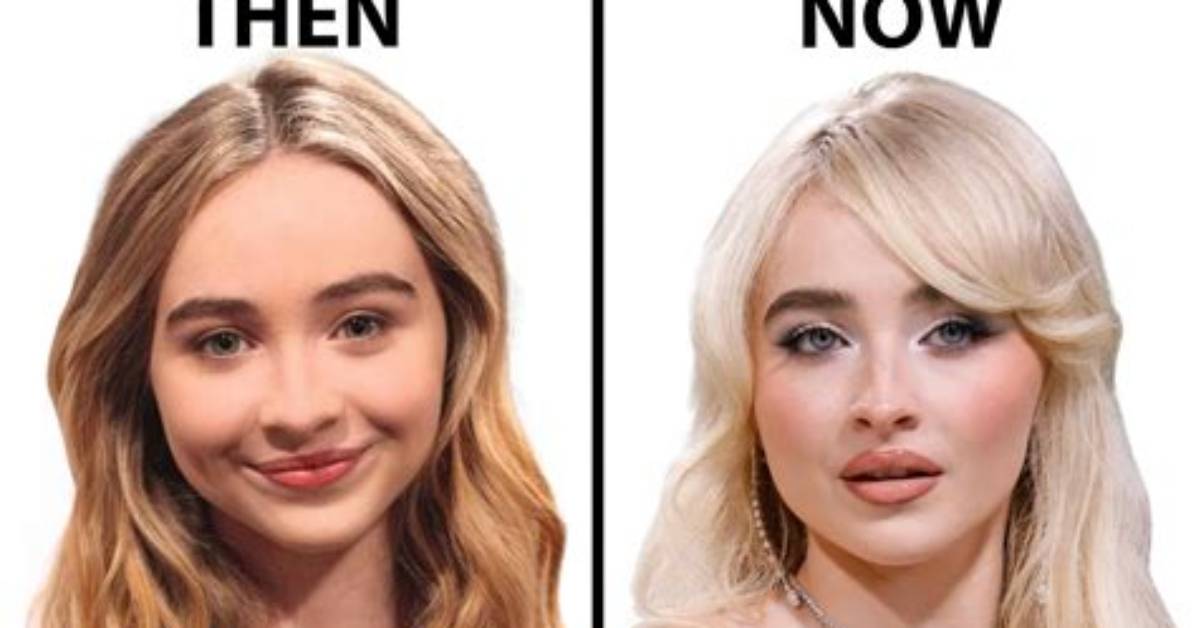 Is Sabrina Carpenter S Flawless Face the Result Of