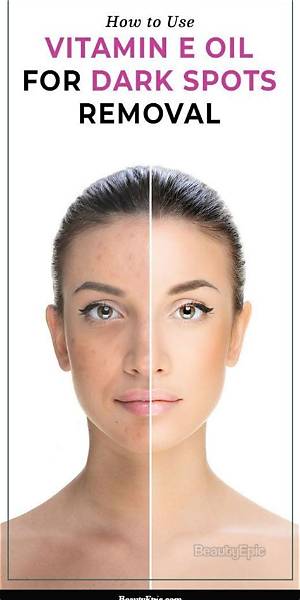 Is Vitamin E Good for Dark Spots?