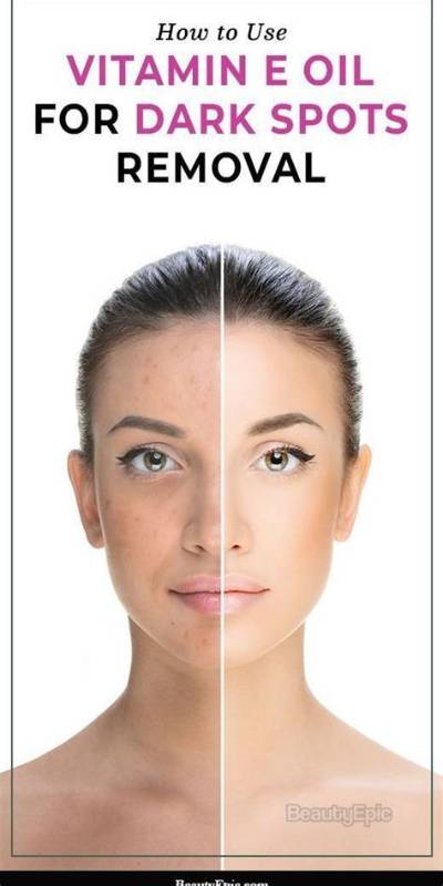 Is Vitamin E Good for Dark Spots?