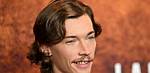 Jacob Lofland's Battle with Bad Teeth: a Comprehensive Guide