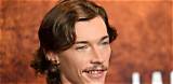 Jacob Lofland's Battle with Bad Teeth: a Comprehensive Guide