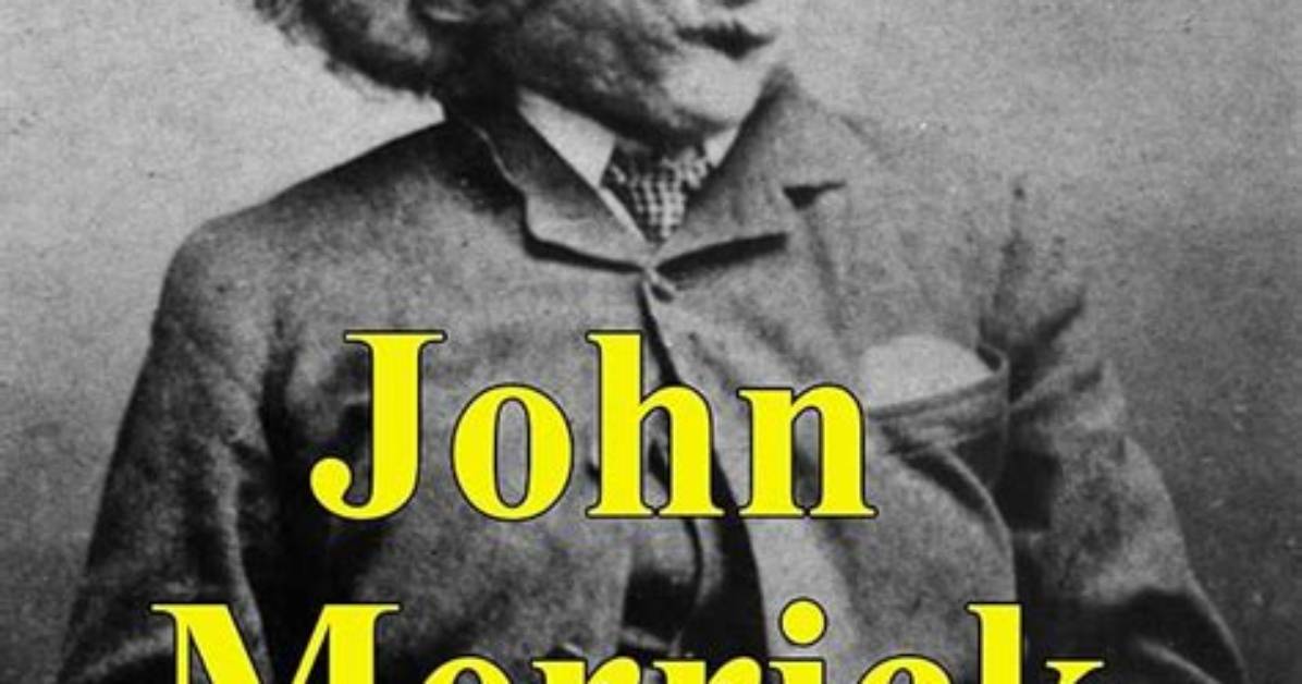 John Merrick Obituary a Life of Triumph Over