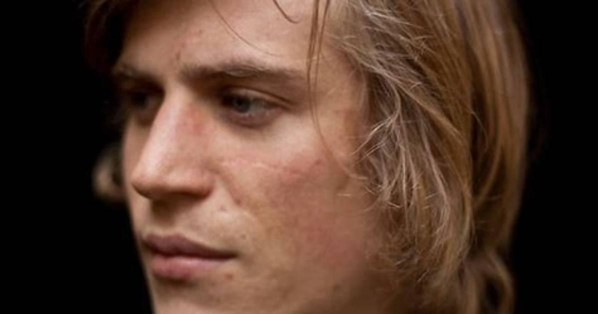 Johnny Flynn S Scar a Window into His Past And