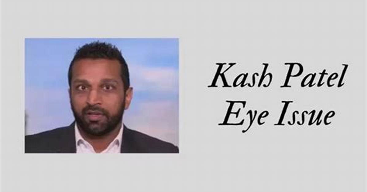 Kash Patel Glass Eye: the Fascinating Story Behind the Iconic Injury