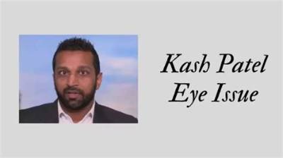 Kash Patel Glass Eye: the Fascinating Story Behind the Iconic Injury
