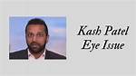 Kash Patel Lazy Eye: a Comprehensive Exploration