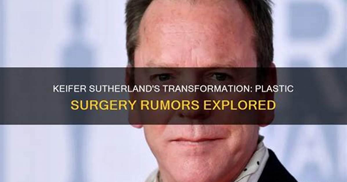 Kiefer Sutherland's Plastic Surgery Transformation: Before and After