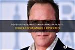 Kiefer Sutherland's Plastic Surgery Transformation: Before and After