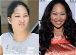 Kim Lee Before and After Plastic Surgery, Who Is Kim Lee?