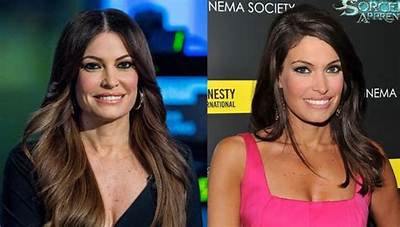 Kimberly Guilfoyle: Before and After Surgery - Transformation Revealed